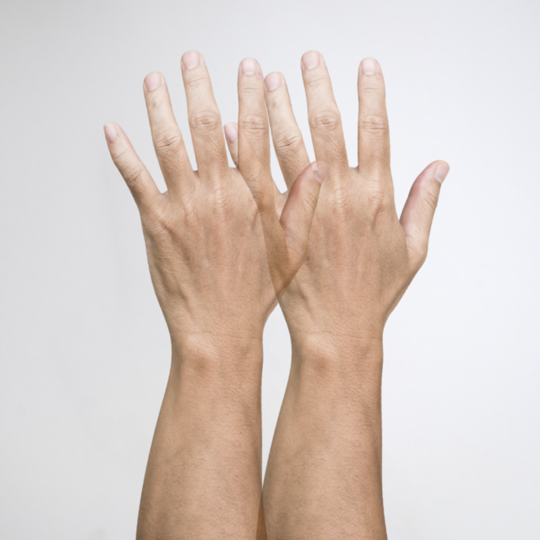 horizontalni dvojni vid