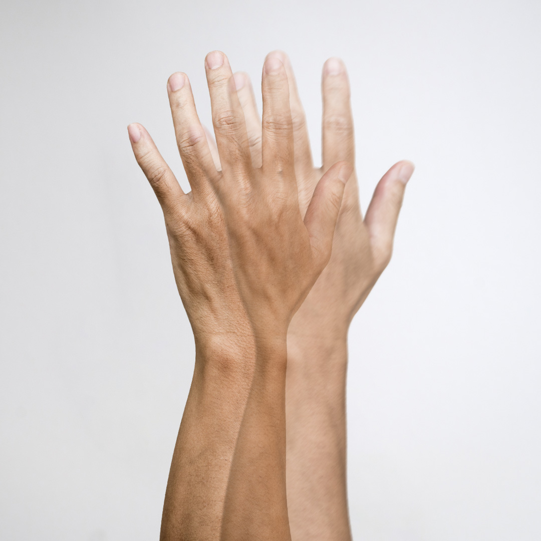 monokularni dvojni vid