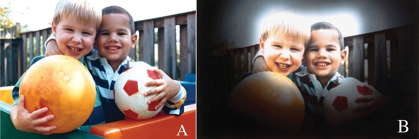 kako vidijo ljudje z glavkomom